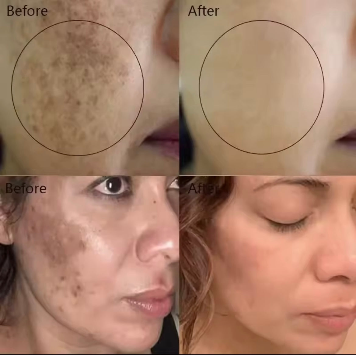 Powerful Dark Spots Remover Whiten Serum Cream Vitamin C Skin Brighten Serum Removal Melasma Dark Spots Repair Beauty Skin Care