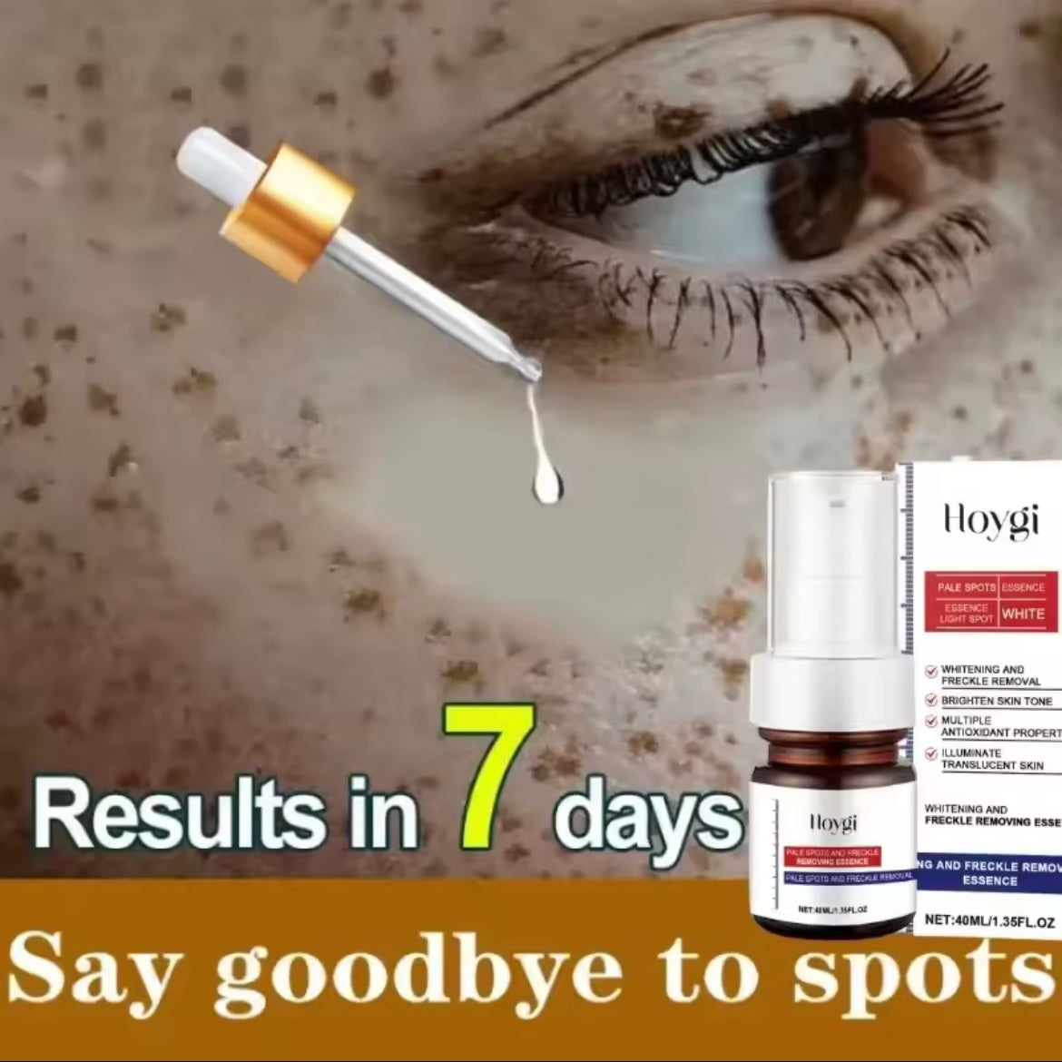 Powerful Dark Spots Remover Whiten Serum Cream Vitamin C Skin Brighten Serum Removal Melasma Dark Spots Repair Beauty Skin Care