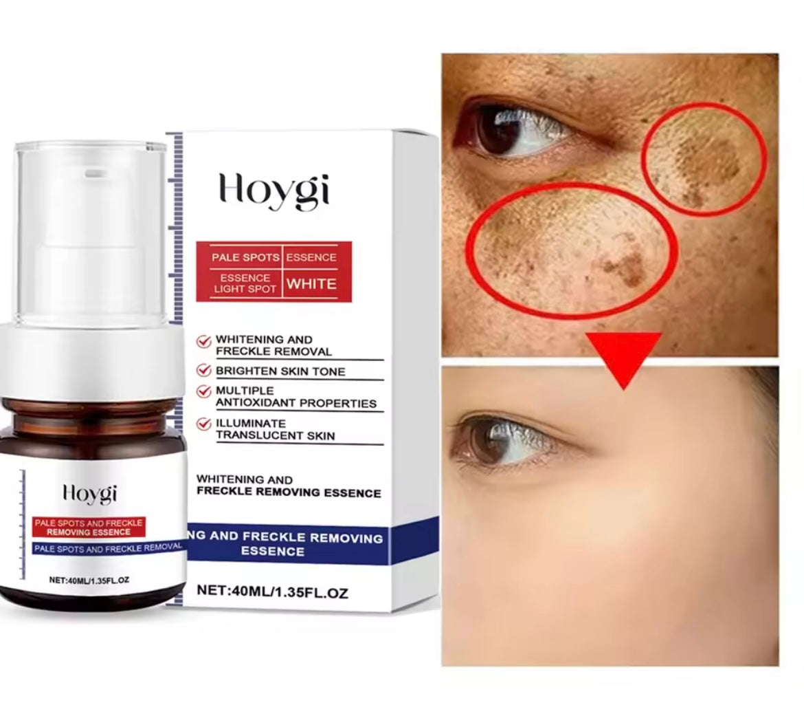 Powerful Dark Spots Remover Whiten Serum Cream Vitamin C Skin Brighten Serum Removal Melasma Dark Spots Repair Beauty Skin Care