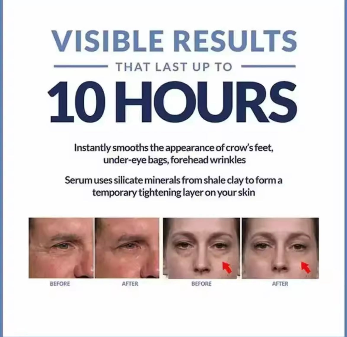 Instant Eye Cream For Anti Aging Dark Circles Bags Puffiness Great Under Eye Skin Face Tightening Eye Lift Treatment Care