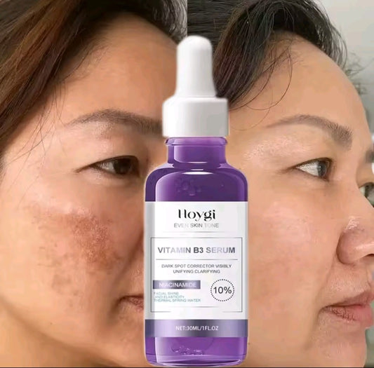 Powerful Dark Spots Remover Freckle Whitening