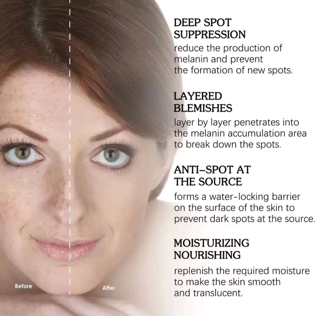 Powerful Dark Spots Remover Freckle Whitening