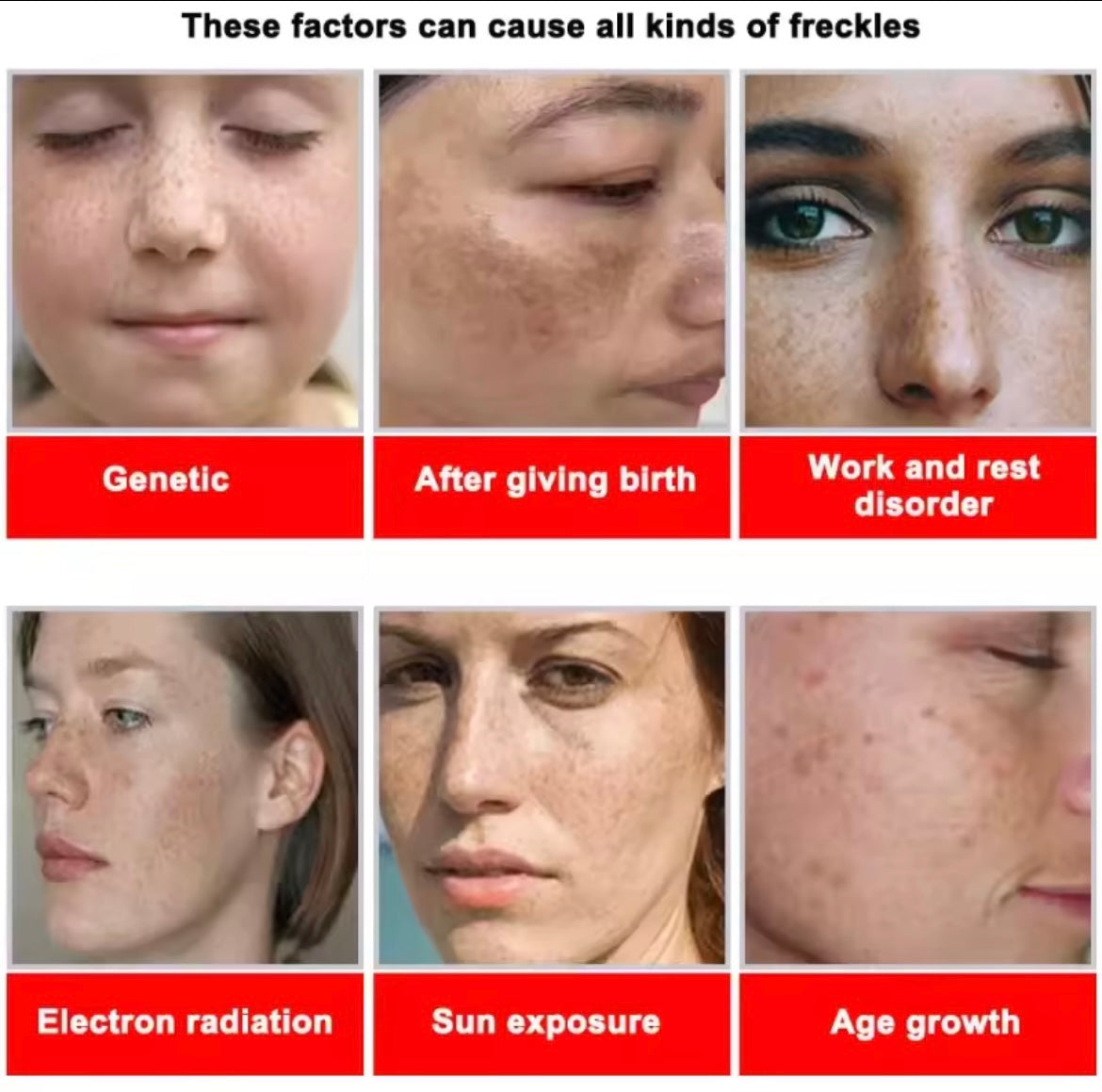 Powerful Dark Spots Remover Whiten Serum Cream Vitamin C Skin Brighten Serum Removal Melasma Dark Spots Repair Beauty Skin Care