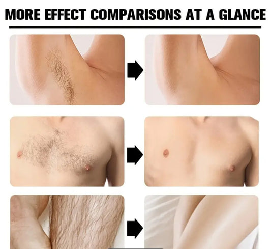 Painless Hair Removal] ROZINO Painless Unisex