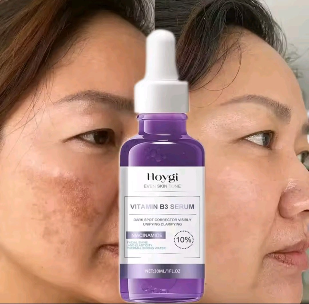 Powerful Dark Spots Remover Freckle Whitening