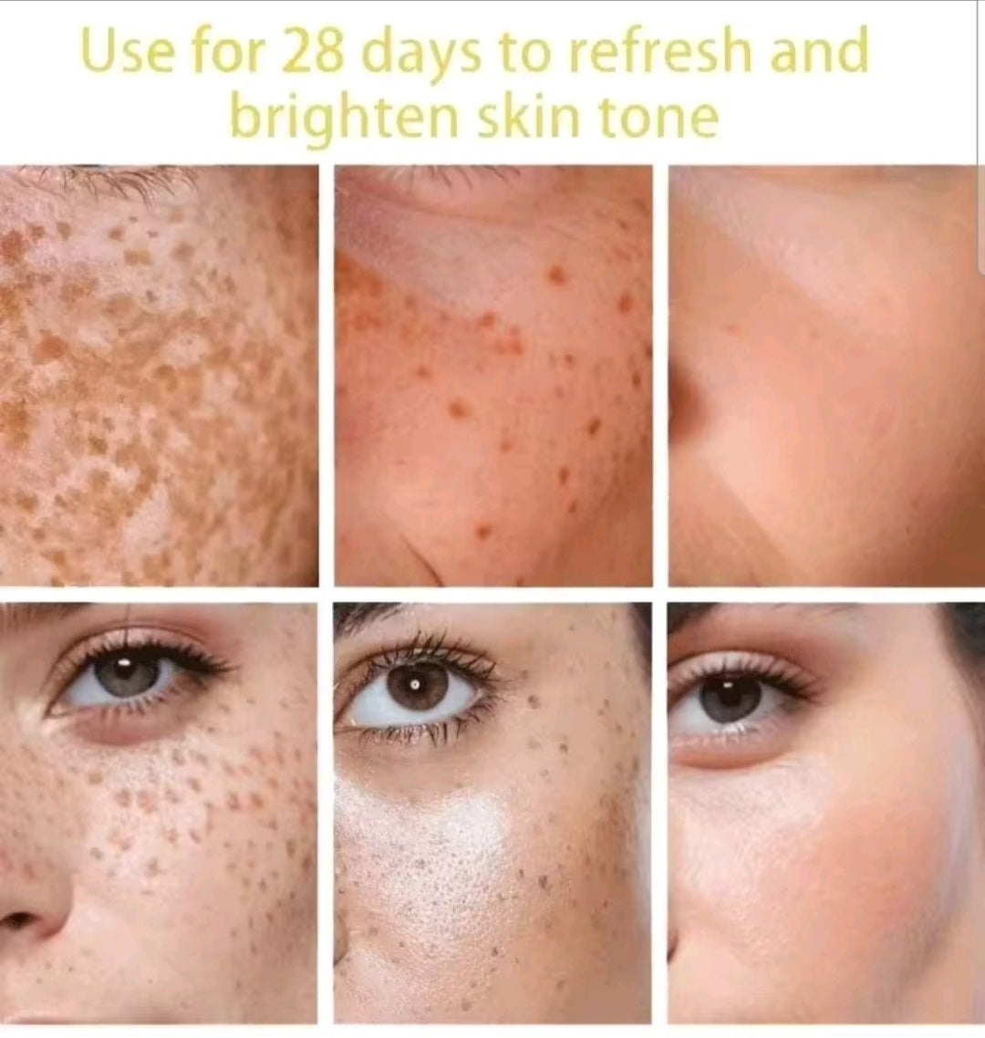 Powerful Dark Spots Remover Freckle Whitening