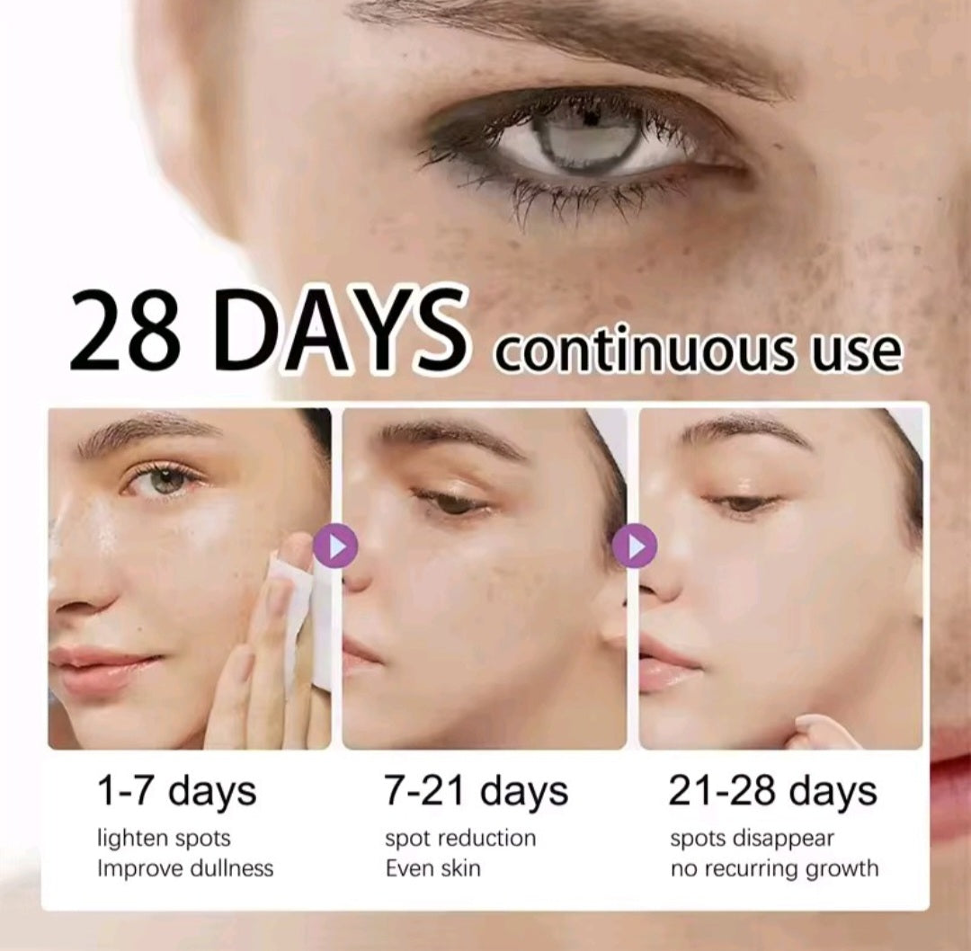 Powerful Dark Spots Remover Freckle Whitening